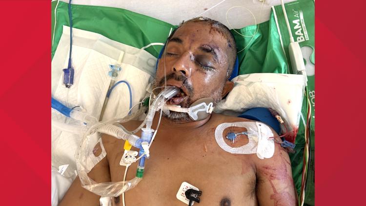 University Hospital asks for help identifying unconscious patient hit by truck Saturday evening — KENS 5 (San Antonio), Waconia Health news