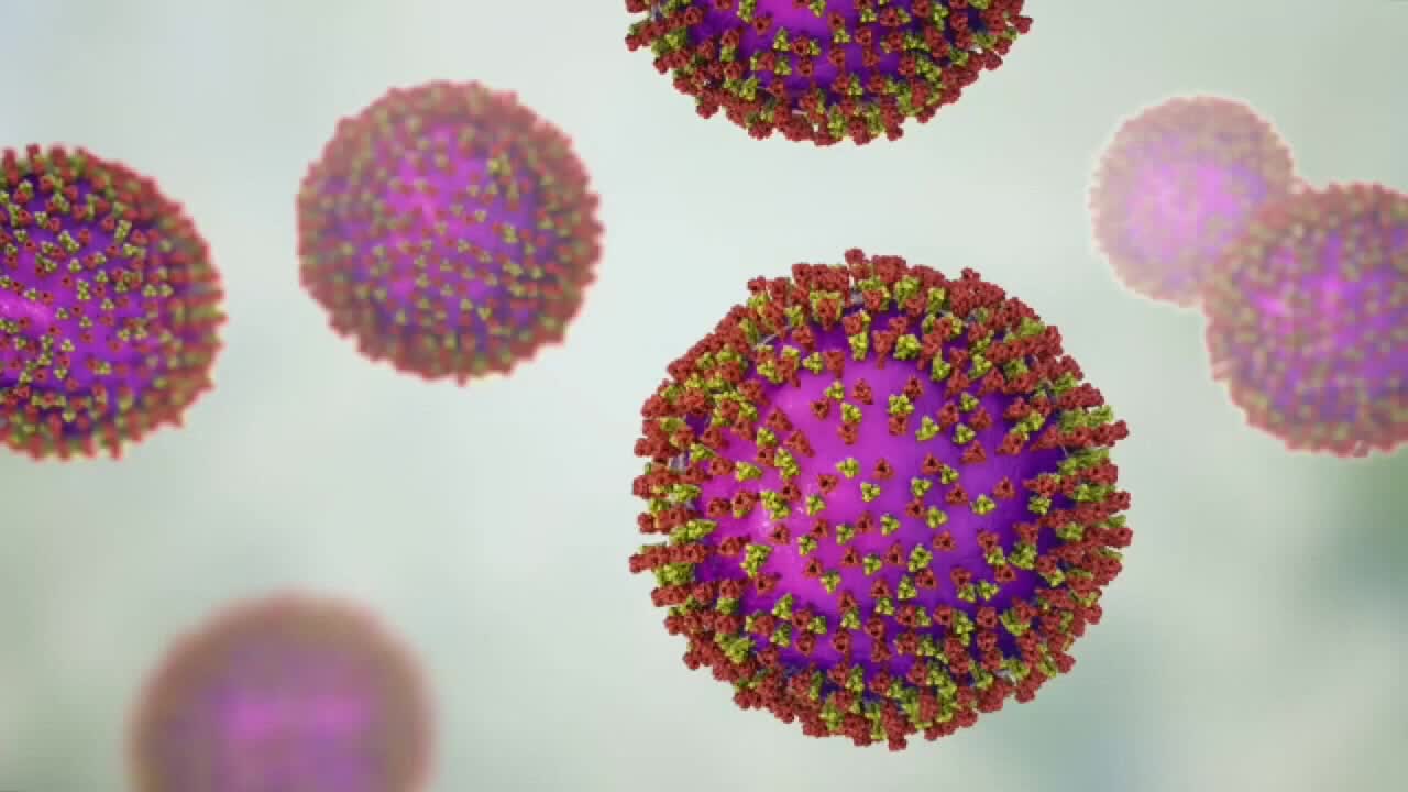 Wisconsin measles outbreak rises to 267 cases as spread continues — FOX 9, Waconia Health news