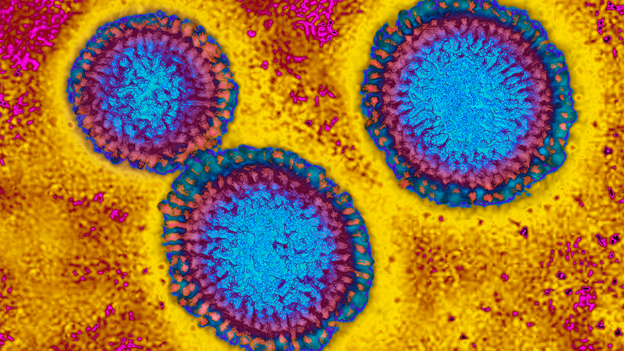Flu hospitalizations 'slightly higher' than usual, officials urge vaccinations — FOX 9, Waconia Health news